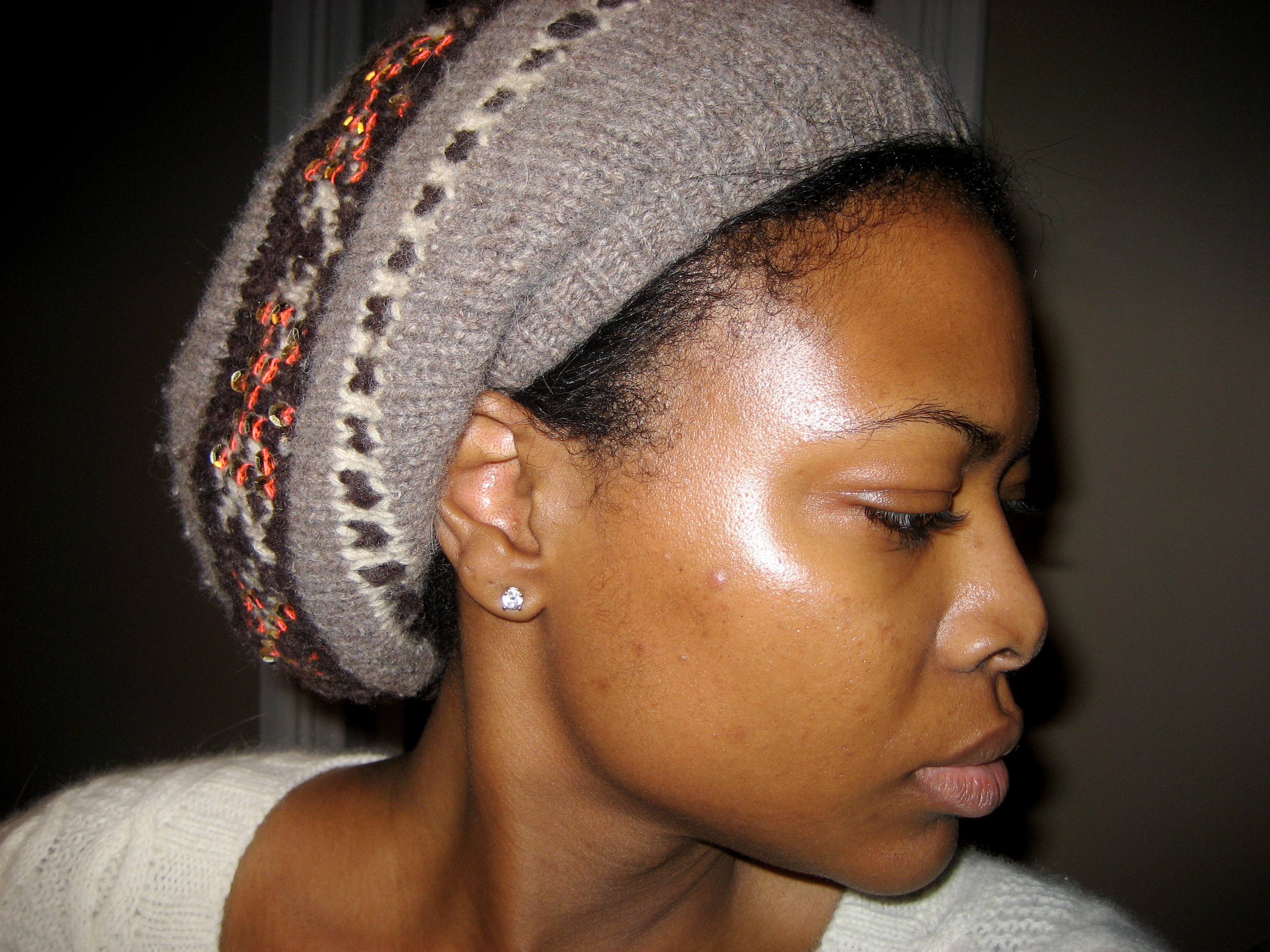 Fade Cream For Dark Spots How To Get Rid Of Hyperpigmentation